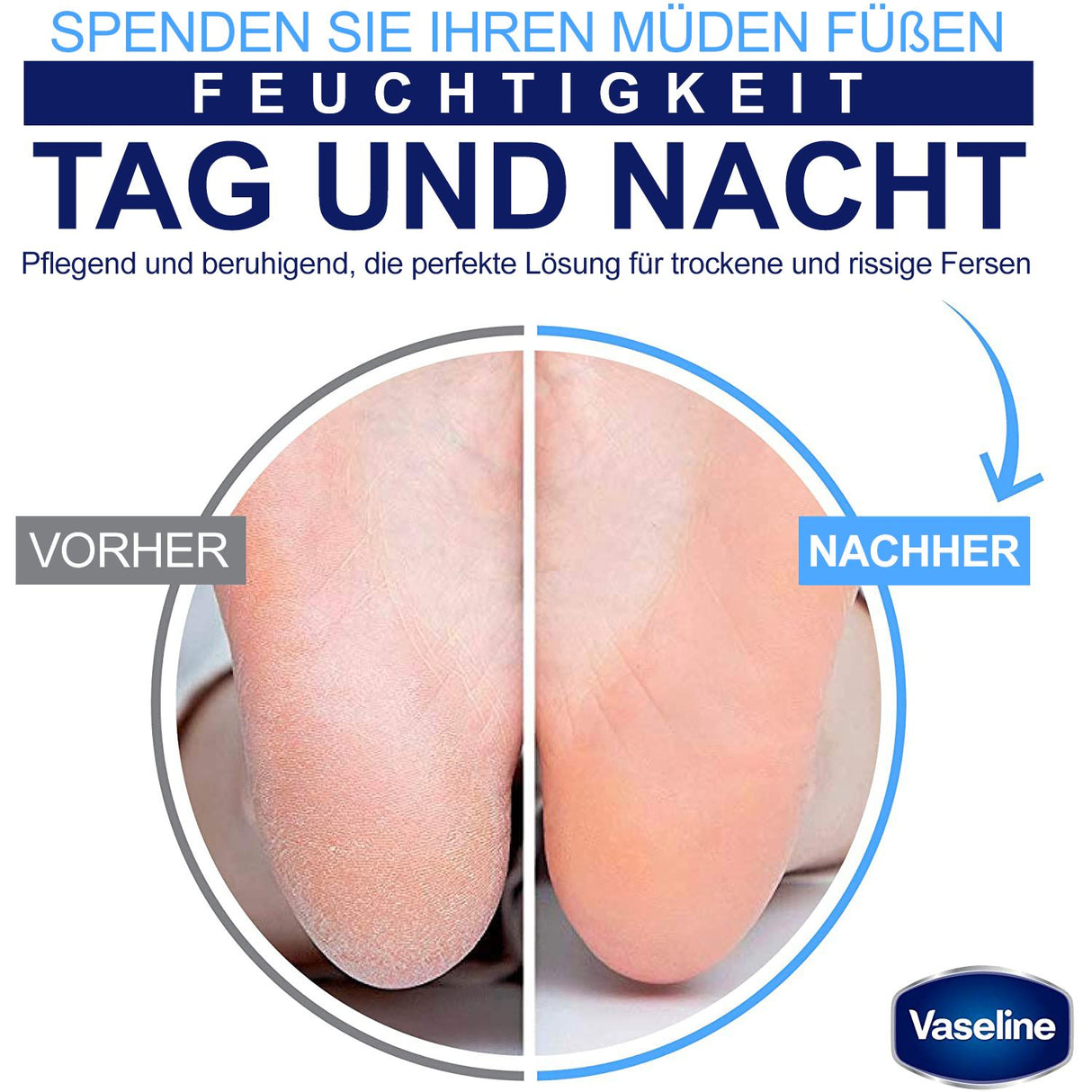 Vaseline Foot Creme | Crème pieds pour le soin quotidien des peaux sèches et abîmées